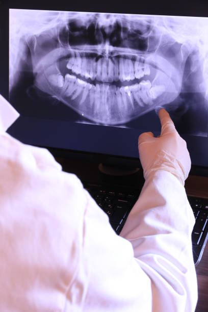 Best Emergency Tooth Extraction in Antioch, CA