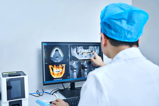 Best Emergency Root Canal Treatment in Antioch, CA